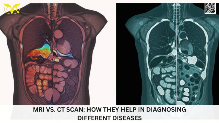 MRI vs. CT Scan How They Help in Diagnosing Different Diseases